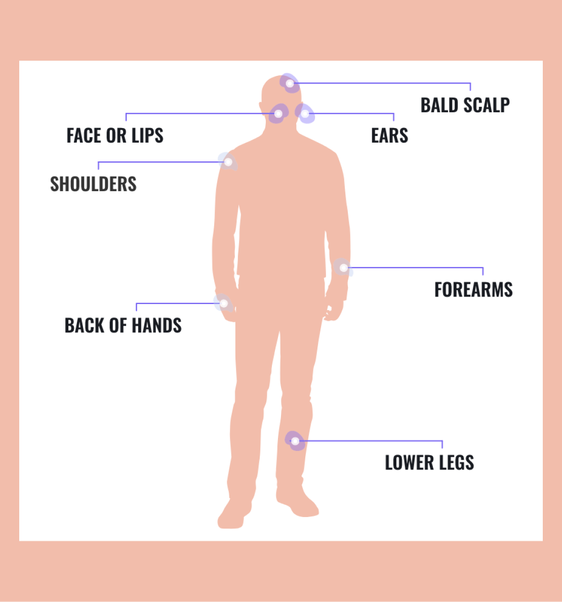 AK AWARE | FACE THE FACTS | Understand Actinic Keratosis (AK) sun damage